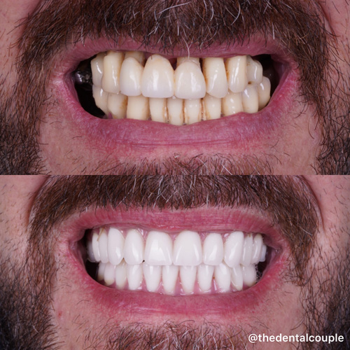 Before and after smile transformation at Smile Spa Camarillo Dentistry — case 27