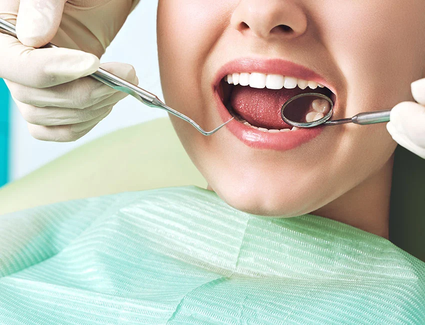 Dental-Sealants.webp
