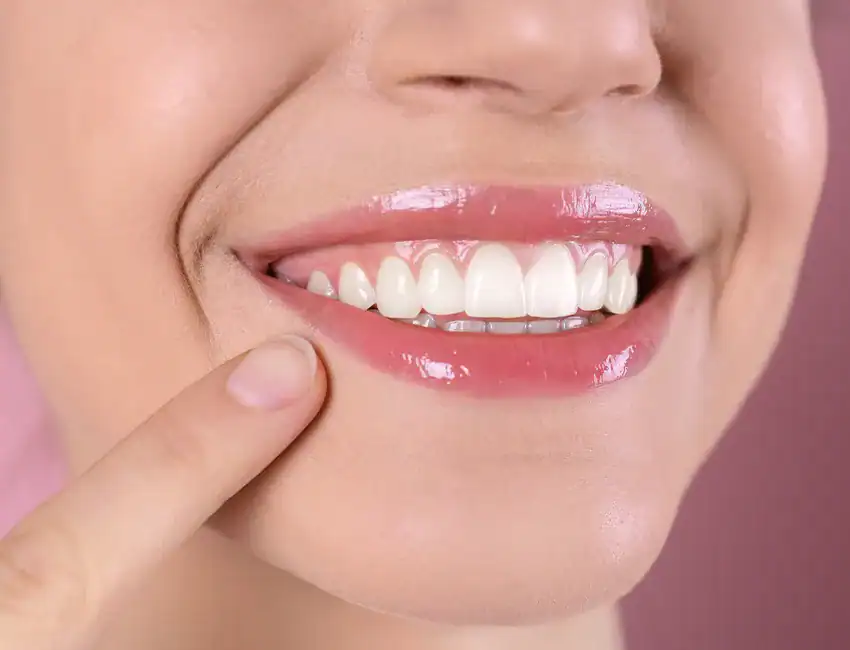 Gum-Contouring-cosmetic.webp