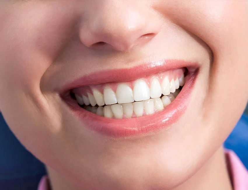 Gum-Contouring-reshaping.webp