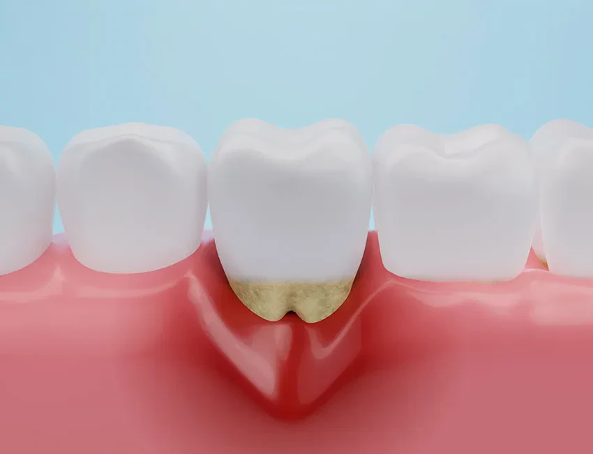 Periodontal Care at Smile Spa Camarillo Dentistry