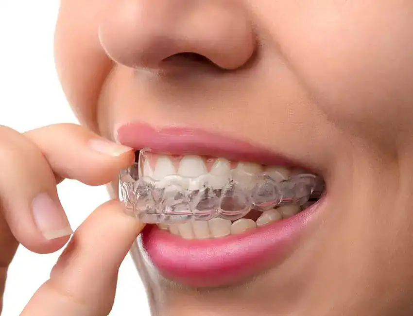 TMD Treatment at Smile Spa Camarillo Dentistry
