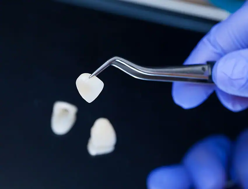 Can Porcelain Veneers Be Removed?