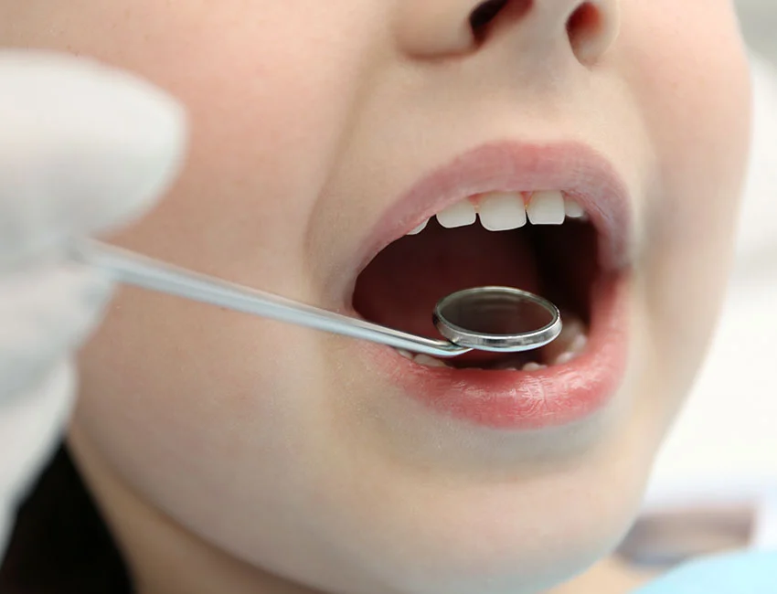 Sealants.webp