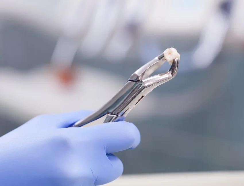 Tooth-Extraction-pain-less.webp
