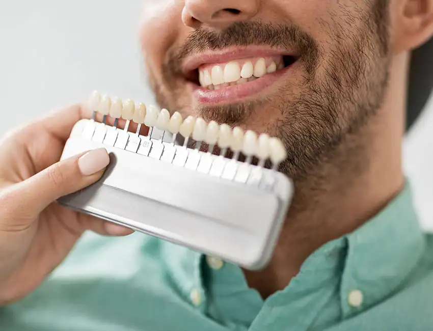 Veneers.webp