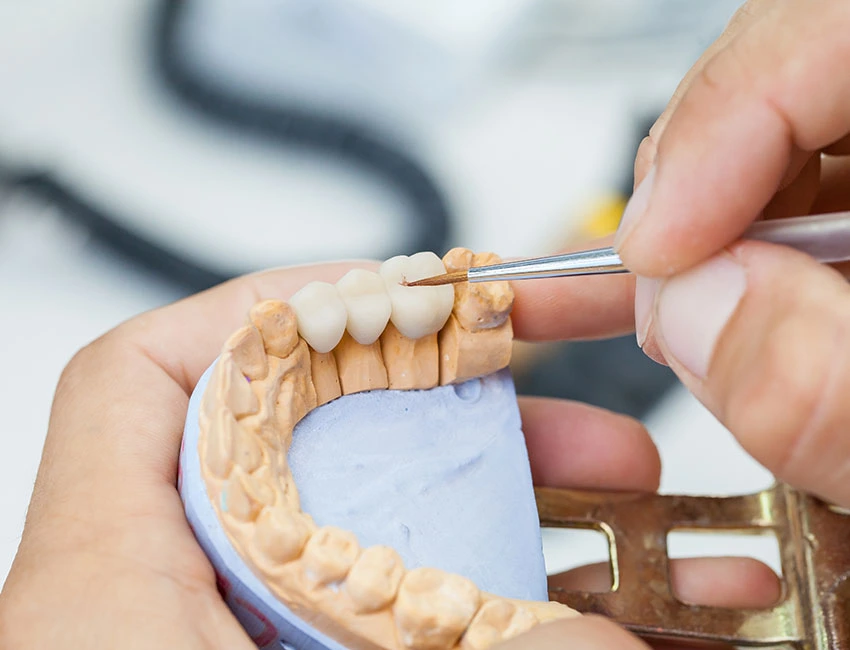 dental-bridge-lab.webp