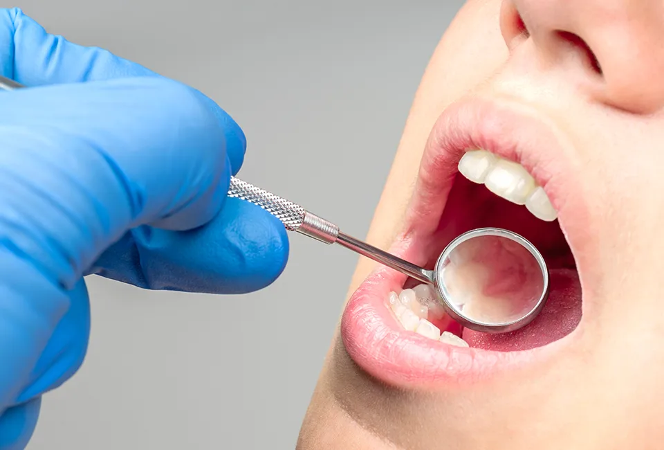 Oral cancer screening at Smile Spa Camarillo Dentistry