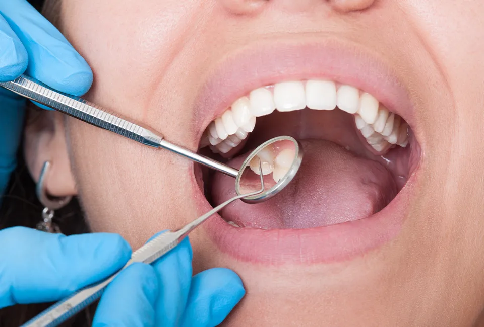 Preventive Dentistry in Camarillo, CA