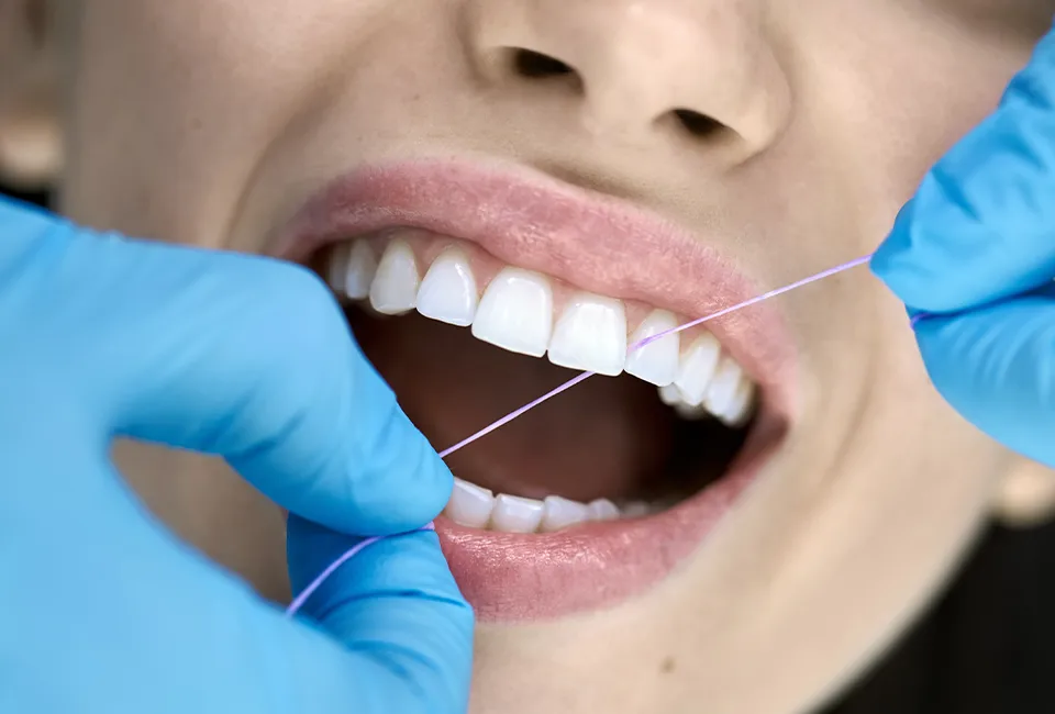The Reason You Should Never Skip Teeth Cleanings