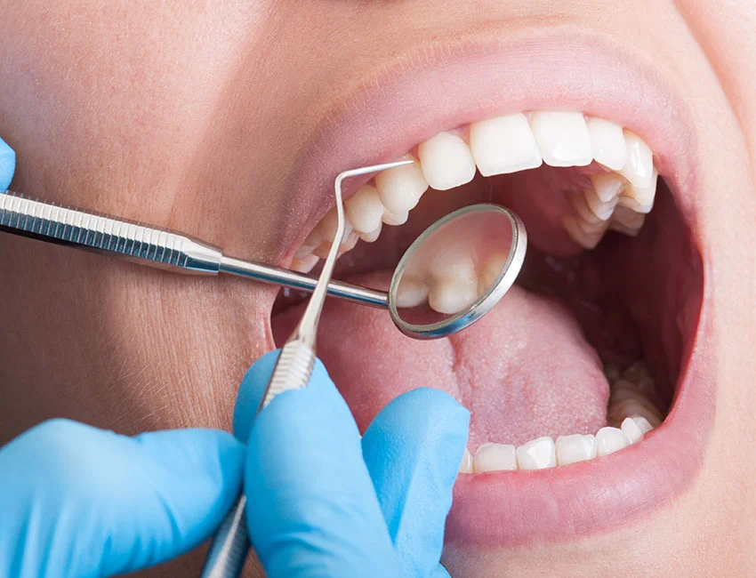 dental-cleanings.webp
