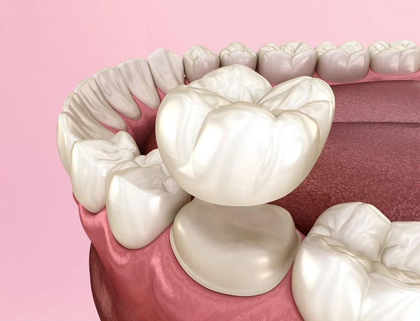 Restorative Dentistry at Smile Spa Camarillo Dentistry