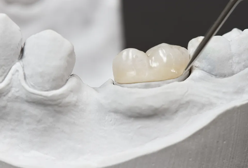 Restorative Dentistry in Camarillo, CA