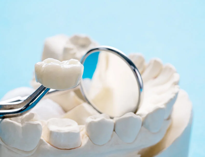 Are Same-Day Crowns as Good as Traditional Crowns?