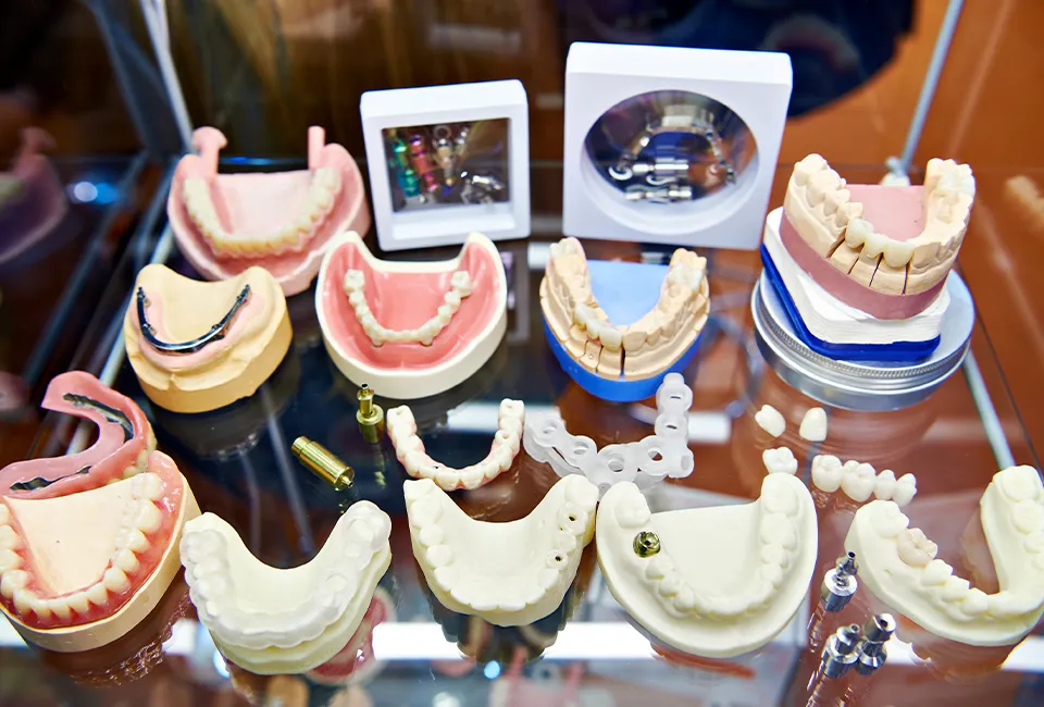 An implant-supported bridge restoration at Smile Spa Camarillo Dentistry