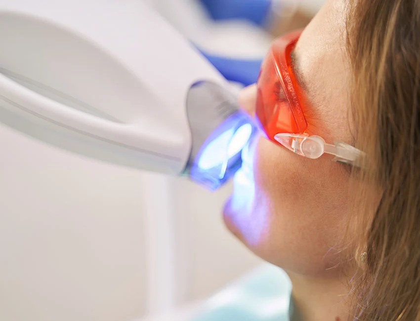 dental-laser-treatment.webp