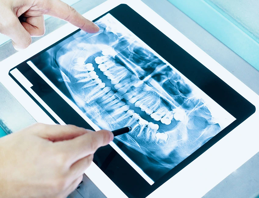 digital-dental-x-ray.webp
