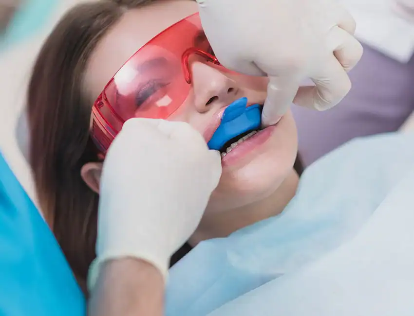 Fluoride Treatments at Smile Spa Camarillo Dentistry