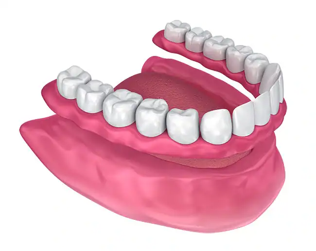 Dentures at Smile Spa Camarillo Dentistry