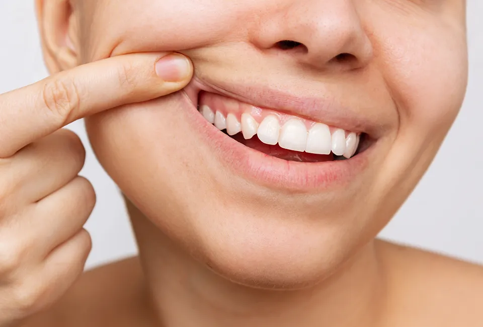 Periodontal Care in Camarillo, CA