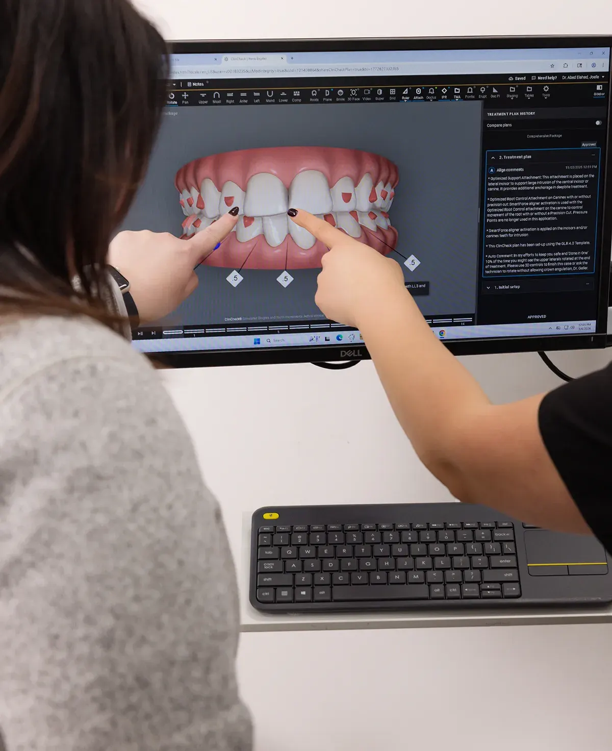 Invisalign clear aligners that correct a range of orthodontic issues at Smile Spa Camarillo Dentistry