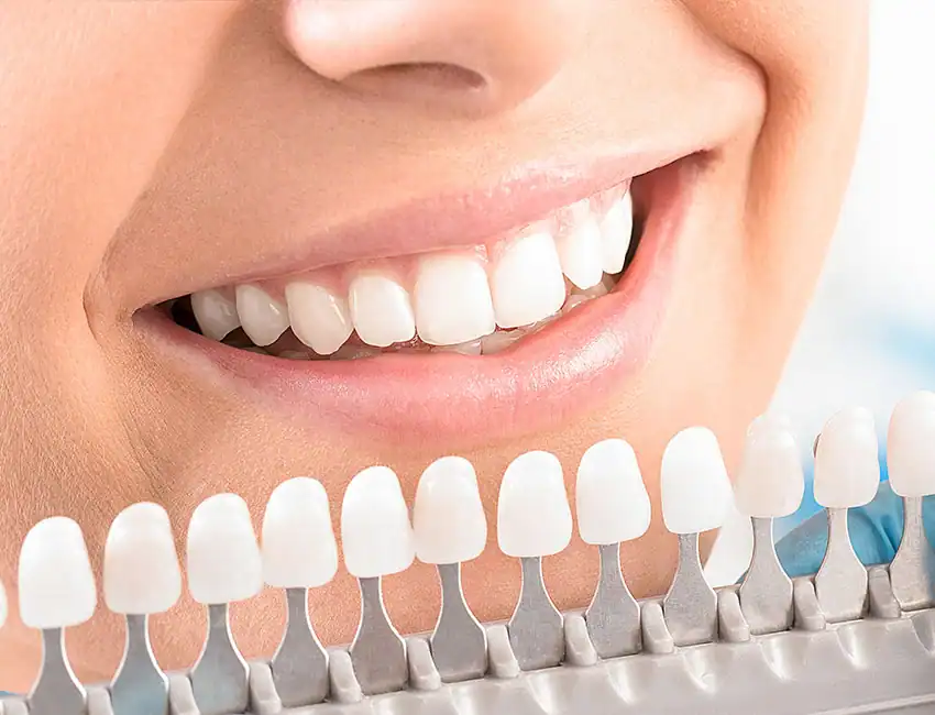 Get a Brighter Holiday Smile with Professional Zoom Teeth Whitening