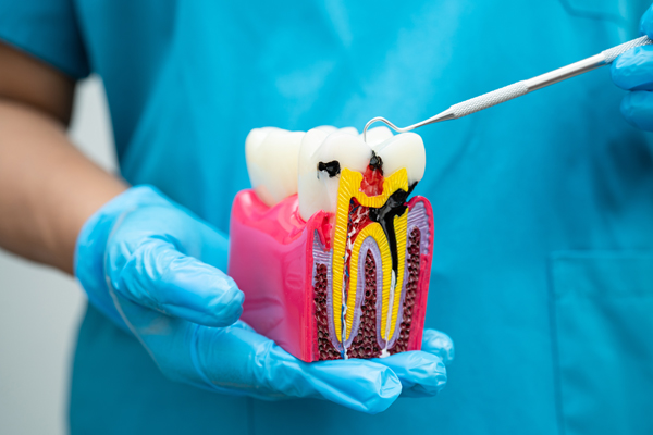 What Is an Endodontist? in Camarillo, CA