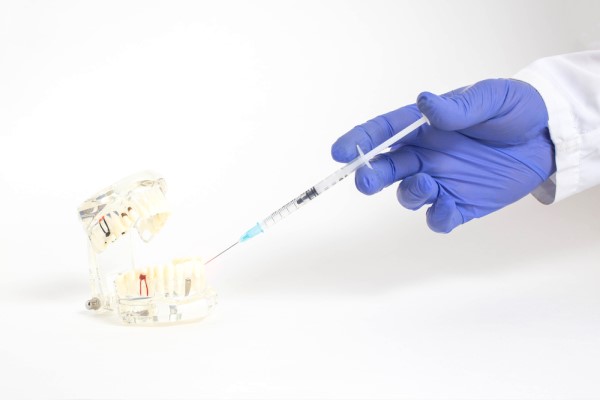 Why choose Smile Spa Camarillo Dentistry for Oral Surgery
