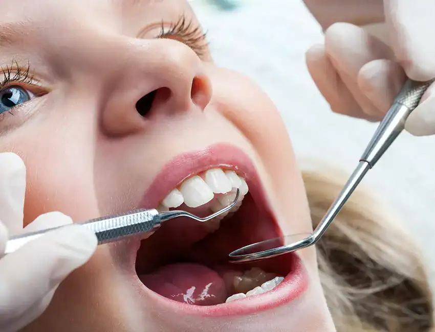 Dental Sealants in Camarillo, CA