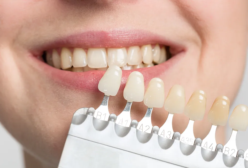 teeth whitening treatments