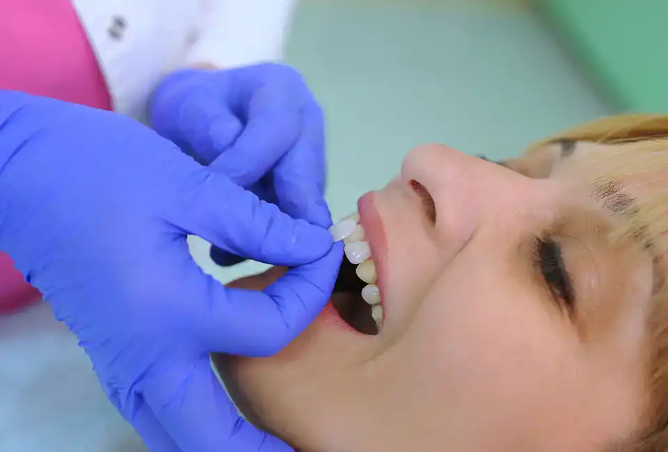 Lumineers® at Smile Spa Camarillo Dentistry