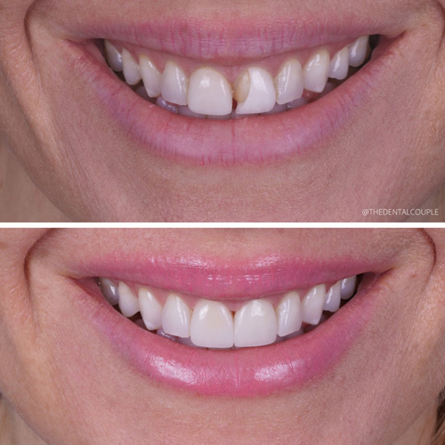 Before and after smile transformation at Smile Spa Camarillo Dentistry — case 30