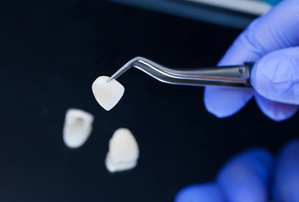 veneers-lab.jpg