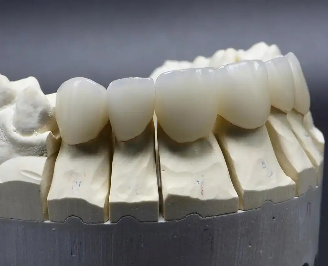 Cosmetic Dentistry at Smile Spa Camarillo Dentistry